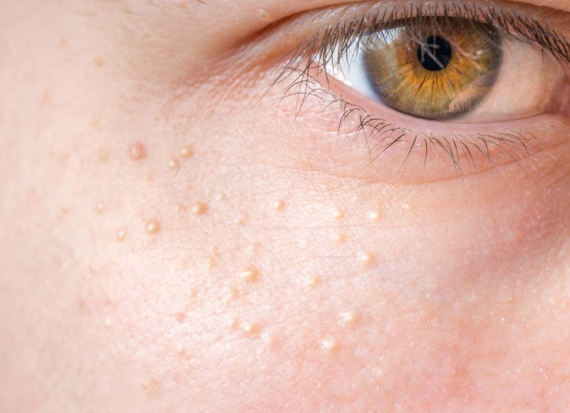 Skin booster image